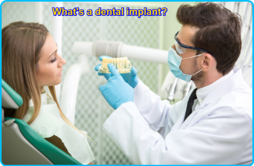 What's a dental implant image