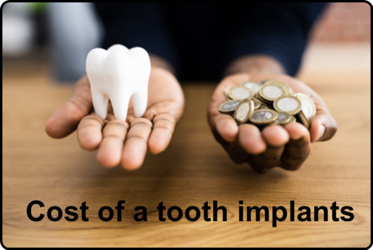 Tooth implant prices