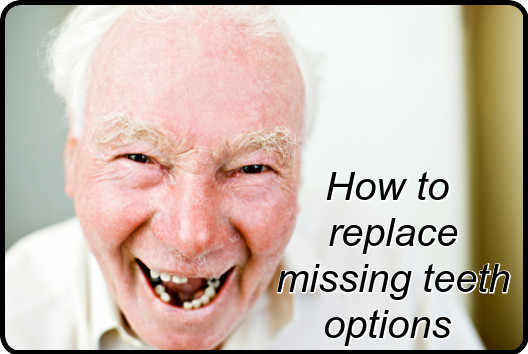 How to replace missing teeth options image