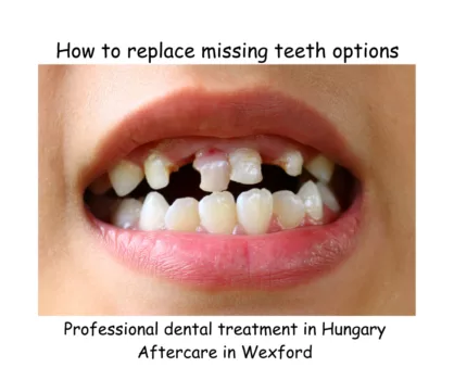 How to replace missing teeth options image 