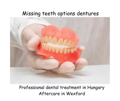 Missing teeth options dentures image