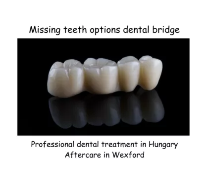 dental bridge image 