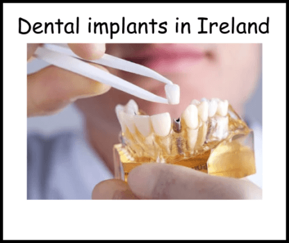 Dental implants in Ireland