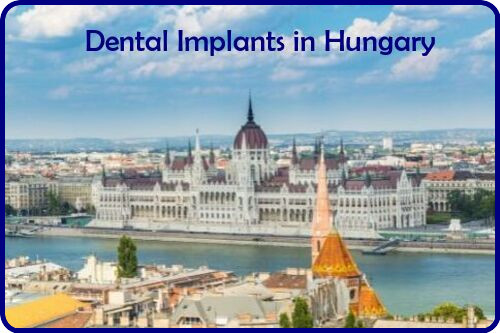 Dental implants in Hungary image