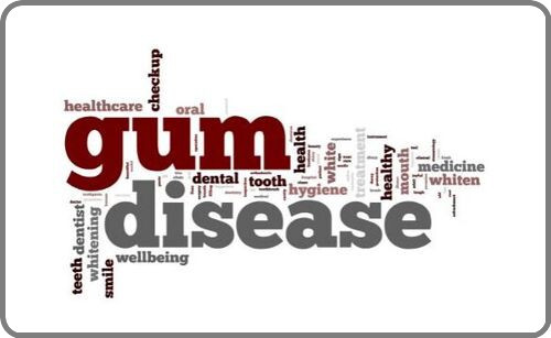 Gum disease image Gum disease image
