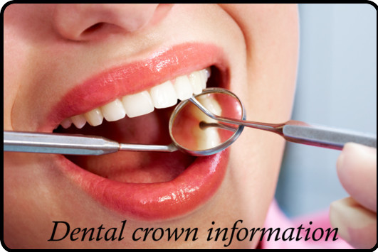 Low cost dental crowns image 2