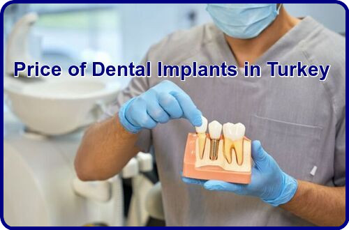 Price of dental implants in Turkey image