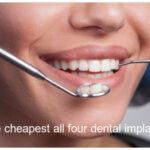 The cheapest all four dental implants image
