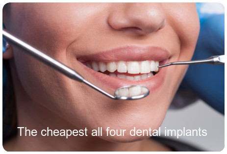 The cheapest all four dental implants