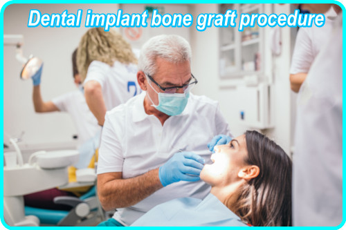 Dental implant bone graft procedure image