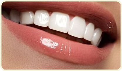 Hollywood smile dental image 3