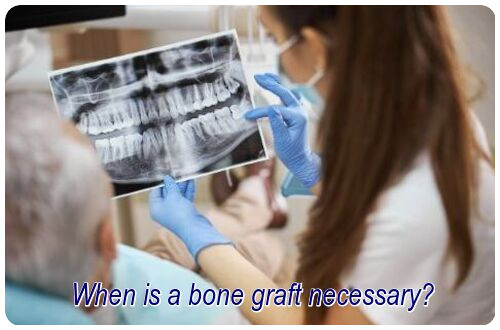 When is a bone graft necessary image