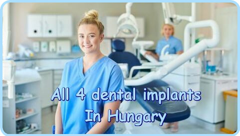 All 4 dental implants in Hungary image