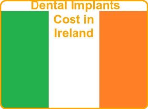 Dental implants cost in Ireland image