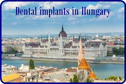 Dental implants in Hungary image