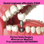 Dental implants affordable image