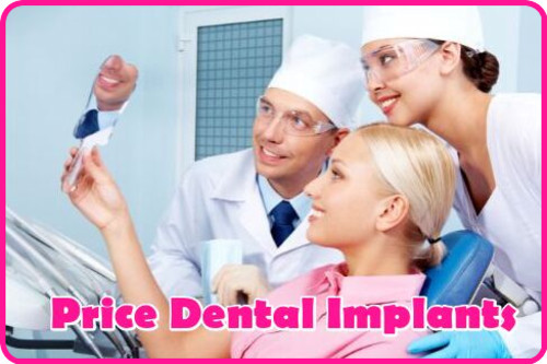 Price dental implants image