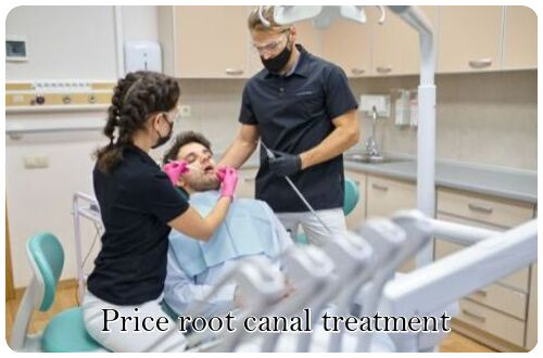 Price root canal treatment