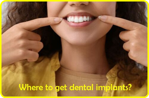 Where to get dental implants image