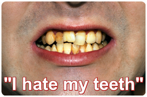 'I hate my teeth 'image