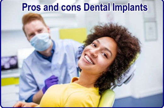 Advantages of all 4 dental implants image