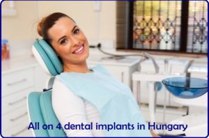 All on 4 dental implants in Hungary image