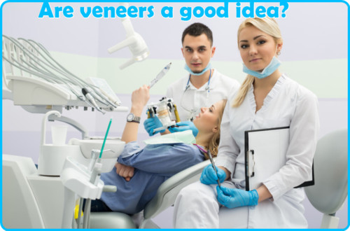Are veneers a good idea