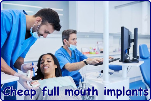 Cheap full mouth implants image