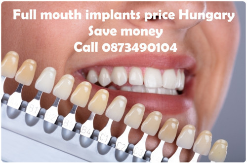 Full mouth implants price Hungary image