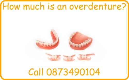 How much is an overdenture?