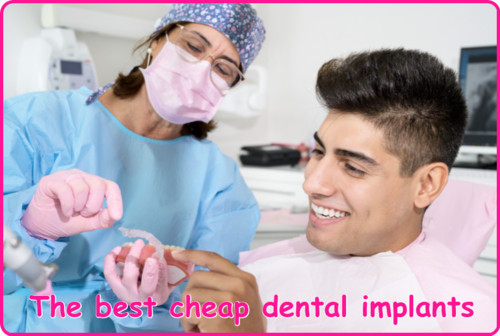 The best cheap dental implants image