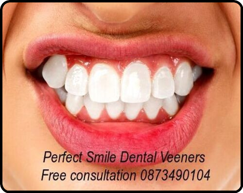 Veneers image