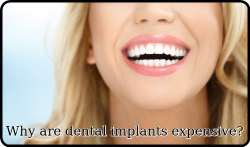 Why are dental implants  expensive image