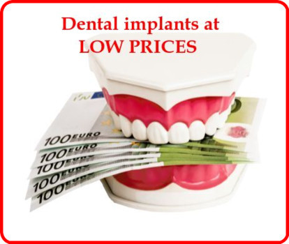 Dental implants at low prices image