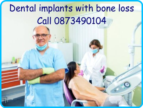 Cost Of A Molar Implant Hungarian Dental Implant Centre Wexford