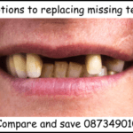 Options to replace missing teeth image