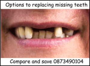 Options to replace missing teeth image