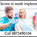Screw in teeth implants image