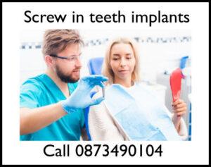 Screw in teeth implants image