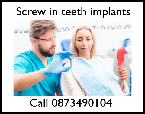 Screw in teeth implants image