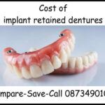 Cost of implant retained dentures image