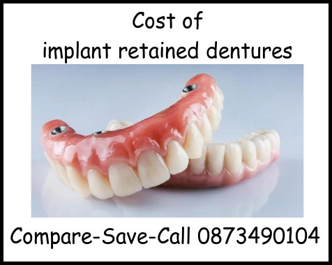 Cost of implant retained dentures image