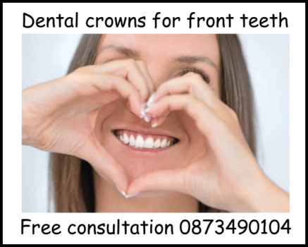 Dental crowns for front teeth image