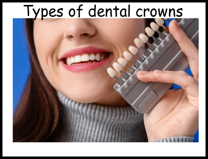 Types of dental crowns image