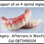 Cheapest all on 4 dental implants image