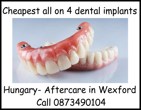 Cheapest all on 4 dental implants image