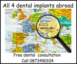 All 4 dental implants abroad image