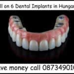 All on 6 dental implants in Hungary image