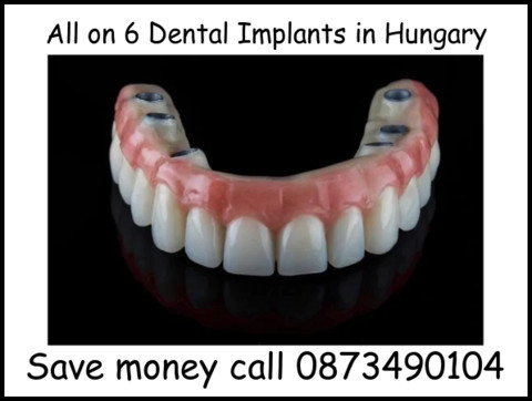 All on 6 dental implants in Hungary image