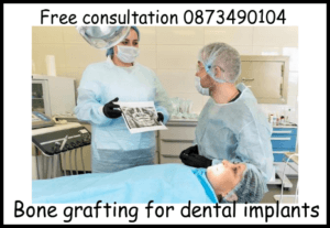 Bone grafting for dental implants image